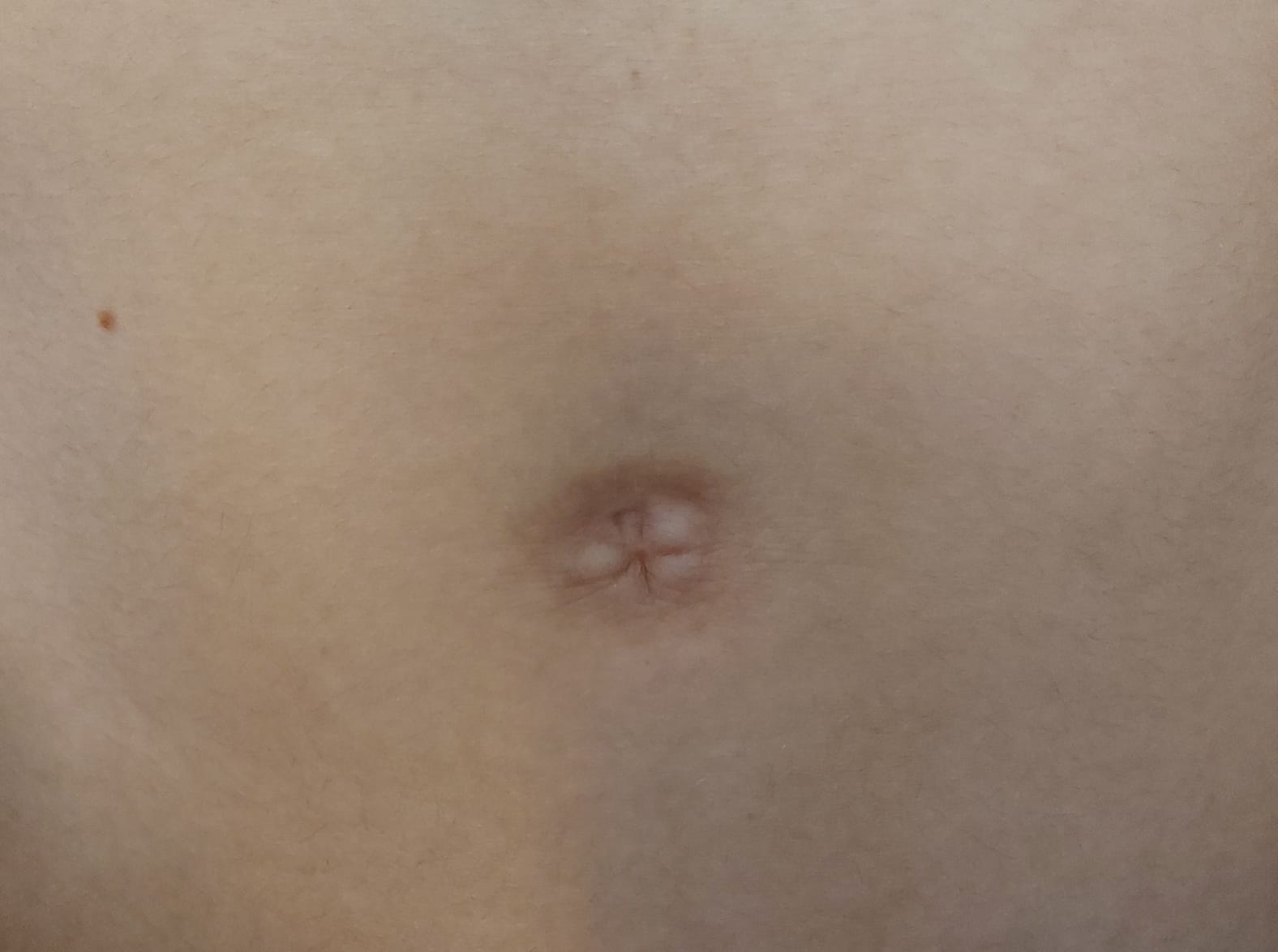 Belly button