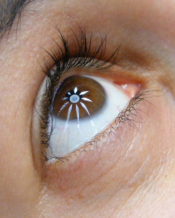 Oog