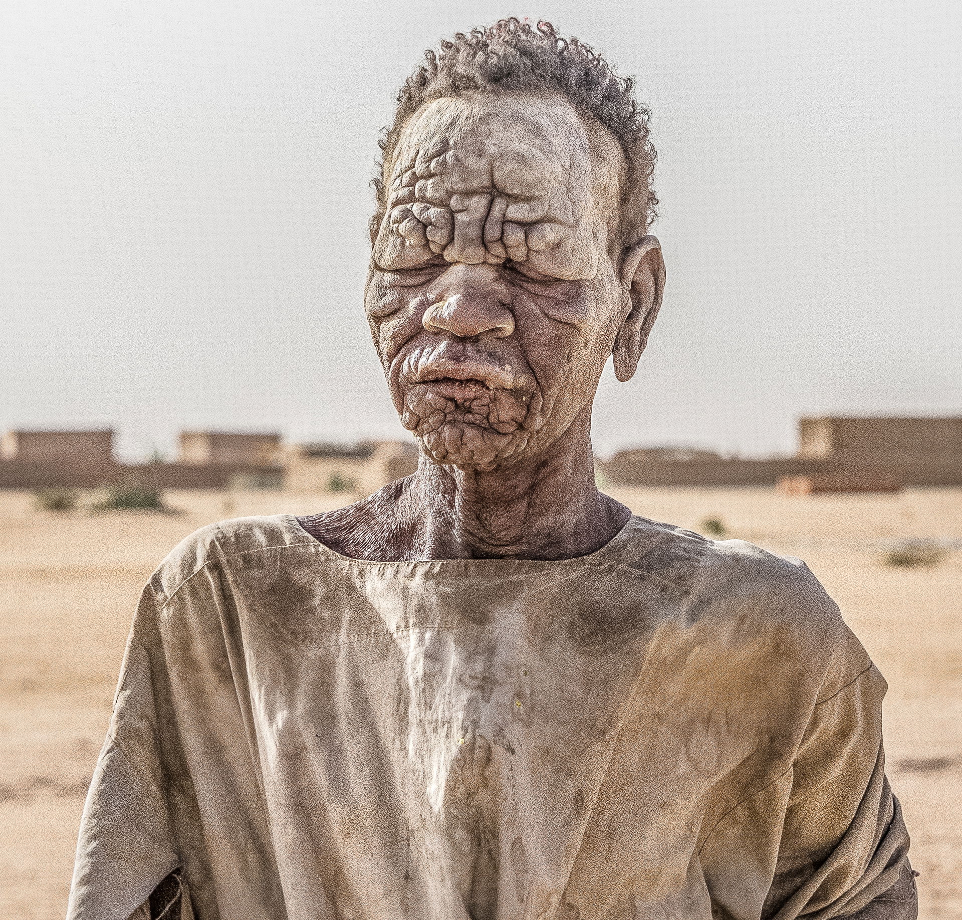 man with leprosy? in small village south of Biltine, Chad