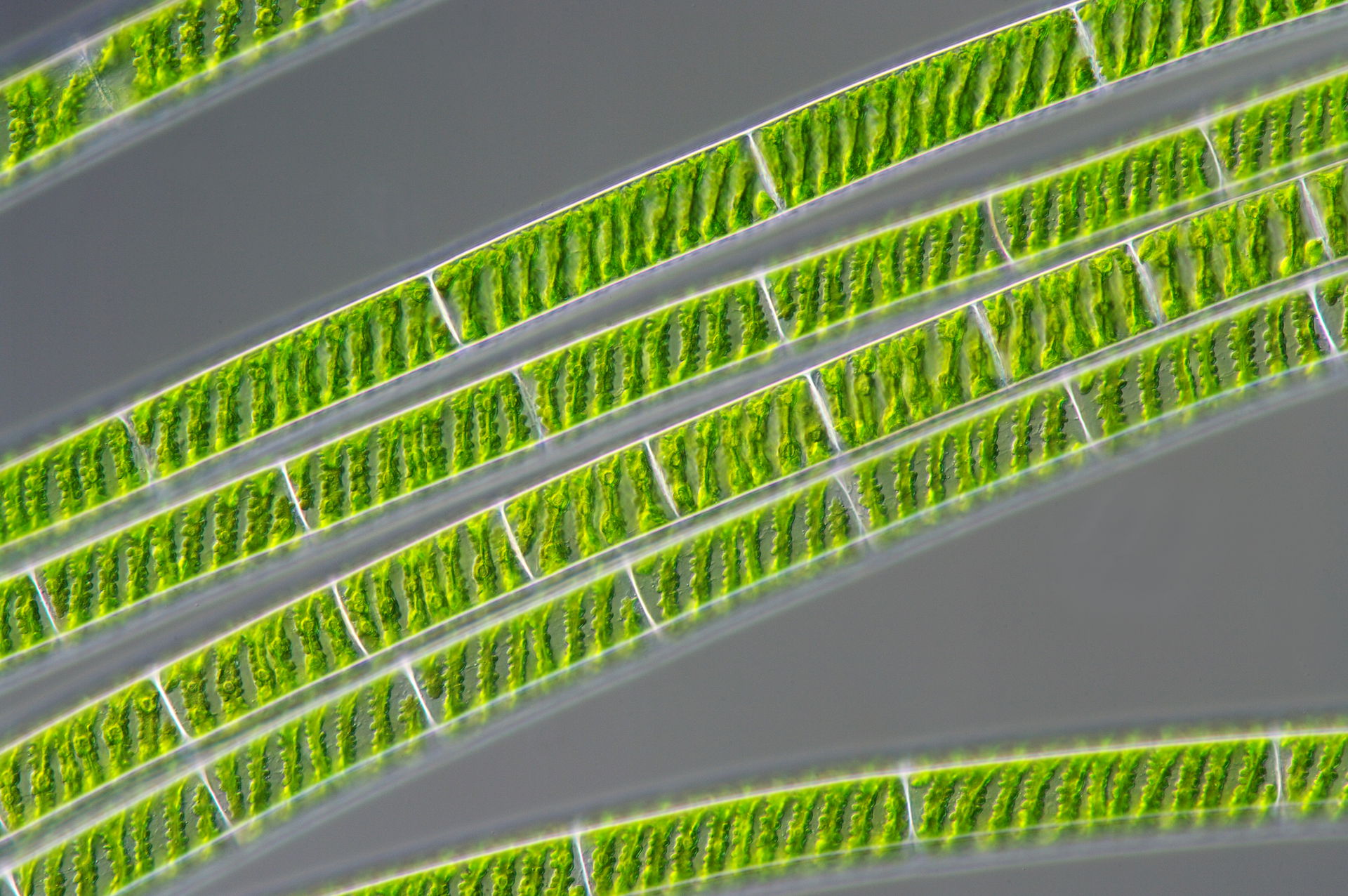 The chloroplasts from Spirogyra are twisted spirally around the…