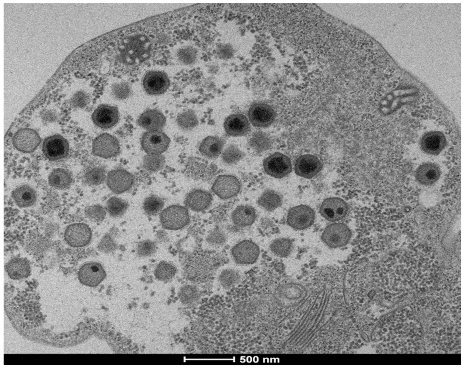Ultrathin section of fadolivirus particles inside its host. The…
