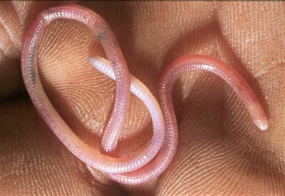 Omboué Worm Lizard (Cynisca bifrontalis)